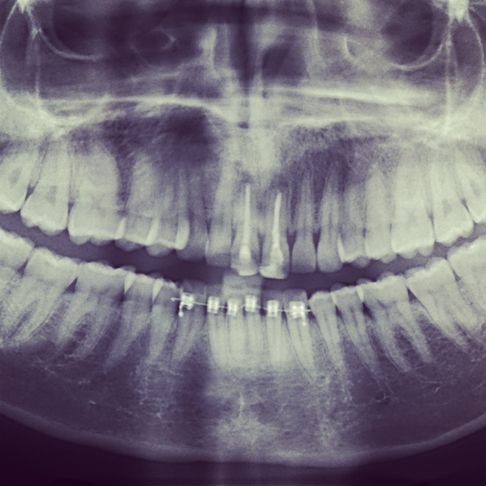 Limited Edition - 184